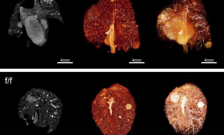 csm microCT images of lung cancer facbb.jpg