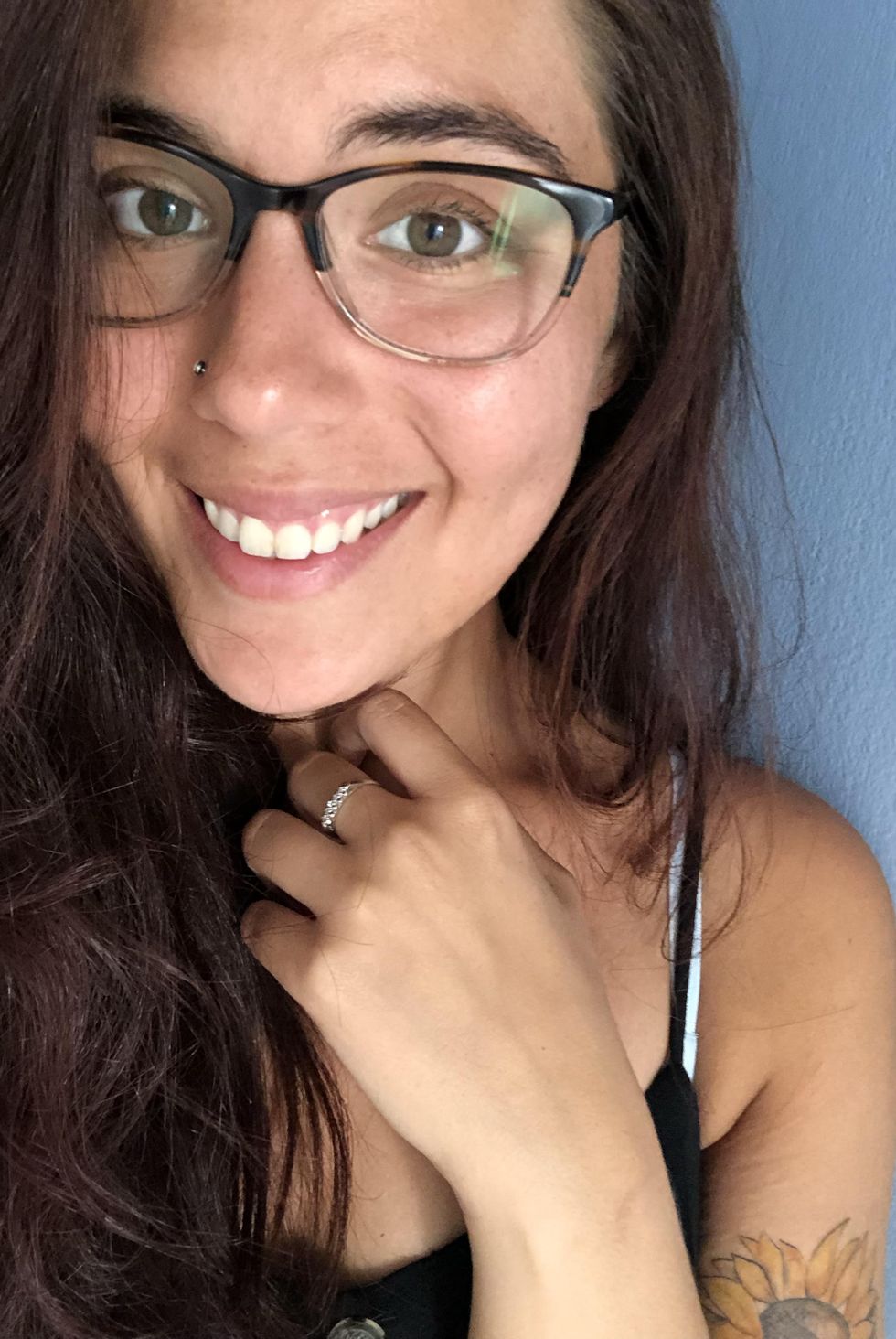 accutane before after